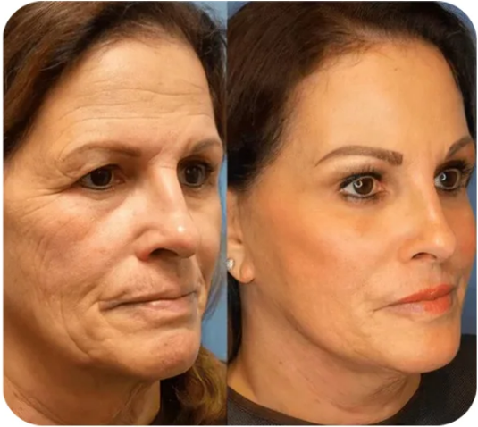 💯【Official Brand Store】Instant Face Tightener No-Filter Primer✨𝐋𝐚𝐬𝐭 𝐃𝐚𝐲 𝐃𝐢𝐬𝐜𝐨𝐮𝐧𝐭: 87% 𝐎𝐅𝐅