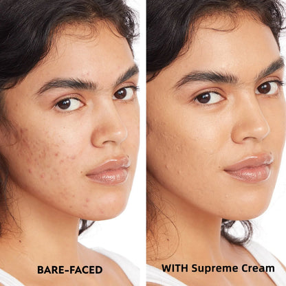 🔥 Last Day Discount: 80% OFF 🌸All Over Complexion Perfector