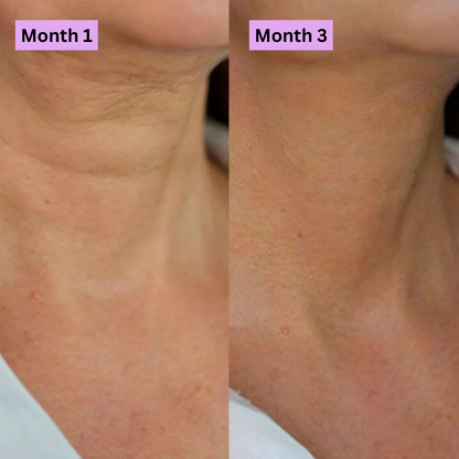 ✨ Collagen Neck Cream – Deeply Hydrates, Firms & Nourishes for a Smooth, Youthful-Looking Neck