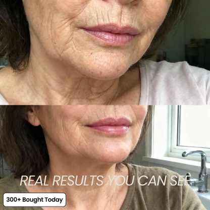👍  Help soften the appearance of wrinkles, fine lines, and tired-looking creases.