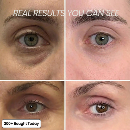 👍  Help soften the appearance of wrinkles, fine lines, and tired-looking creases.
