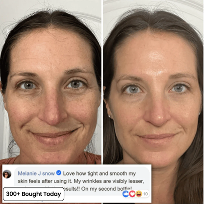👍  Help soften the appearance of wrinkles, fine lines, and tired-looking creases.